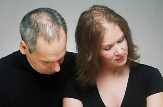 Herbal Supplements for Hair Loss